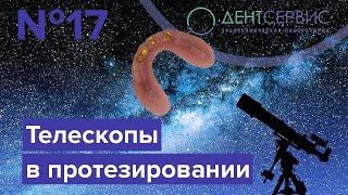 Что такое телескопические коронки?