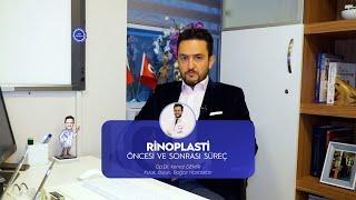 Rinoplasti Öncesi ve Sonrası Süreç