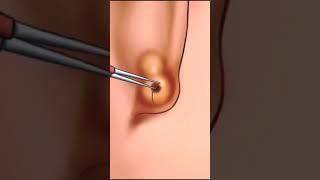 Earring hole clean animation process #asmr