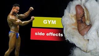 Bodybuilding side effects | Bangla Fitness Tips