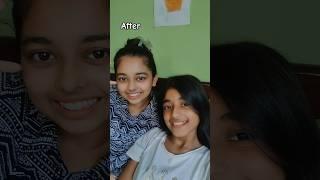 Rida and Roha before vs after#subscribe#trend#sisters#shorts