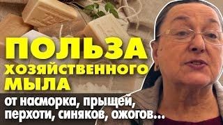 ПОЛЬЗА ХОЗЯЙСТВЕННОГО МЫЛА || от насморка, прыщей, перхоти, синяков, ожогов || добрые советы