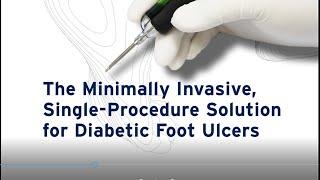 DigitalGraphic DFU  healthcare MKT 379 003RevA