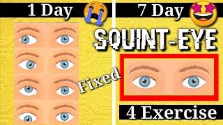 Squirt Eye TREATMENT 4 Exercise at home