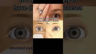 Do this simple test if you experience dizziness, nausea, or feel “off balance” but doctors haven’t