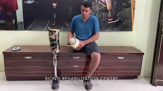 Above knee prosthesis- Bionis rehabilitation centre #abovekneeprosthesis #amputation #prostheticleg