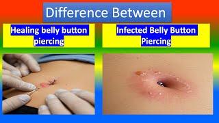 Distinction between Healing belly button piercing  and Infected Belly Button Piercing