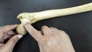 7. Femur-I