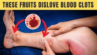 Top 7 FRUITS that Dissolve BLOOD CLOTS Naturally