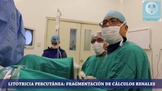 Dr. Miguel Suárez - Litotricia Percutánea