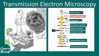 Transmission electron microscopy (TEM) | Principles and application of TEM | limitations of TEM