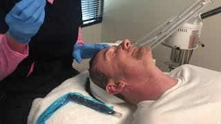 Microneedling w/ PRP at Flowers Medical Group