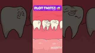 Replacing a decayed Molar with a Wisdom Tooth?!  (Animated Dental Adventure)
