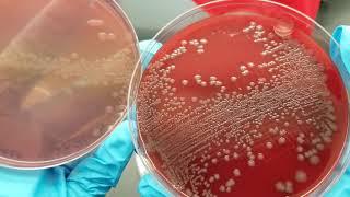 Microbiology: Urine Culture Primary Set-Up Inoculation and Colony Count