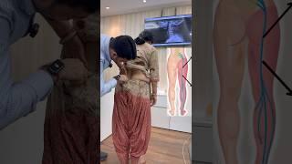 Sciatica pain treatment by dr harish grover #trend #ytshort #feedshort #foryou