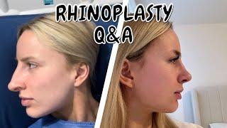 Rhinoplasty Q&A | Returning to the gym, price, surgeon | 2 months post op