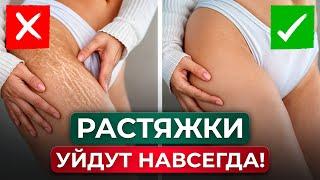 ЛУЧШИЕ СПОСОБЫ избавиться от растяжек на теле! / Как вернуть коже тонус и упругость БЕЗ ТРЕНИРОВОК?