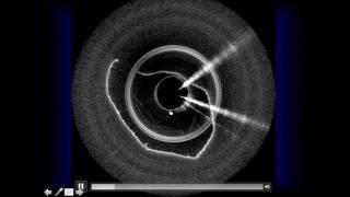 Emerging Applications for Optical Coherence Tomography in the Head, Neck, and Upper Airway