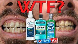 How Carnivore Diet + Dr. Ellie Phillips Destroyed My Teeth