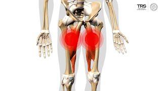 Trigger Point Anatomy Tutorial: Hip Adductors and Hamstrings