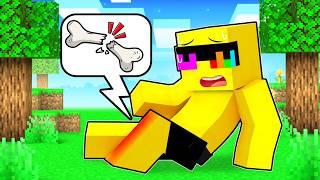 Sunny BROKE HIS LEG in Minecraft!