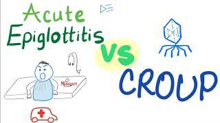 Acute Epiglottitis Vs Croup | A Detailed Comparison