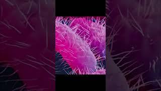CDC issues warning over an increase of drug-resistant Shigella bacteria