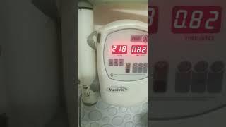 dental x-ray timer RBC comfortable#shorts #dental #trending #youtubeshorts