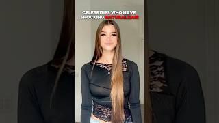 Celebrities Who Have Shocking Natural Hair 