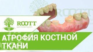 Атрофия костной ткани.  Чем опасна атрофия костной ткани?Клиника ROOTT