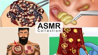 Combine ASMR Treatment Animation | Removal Of Maggot Infected Animation | JINJJA 진짜 ASMR