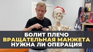 Почему болит плечо? Вращательная манжета. Когда нужна операция?