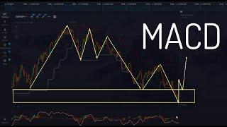 BINARY OPTIONS TRADING STRATEGY 2025 | MACD INDICATOR STRATEGY | BEST TRADING STRATEGY 2025