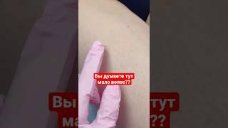 Как покрасить волосы на ногах?? #электроэпиляция #обучениеэлектроэпиляции