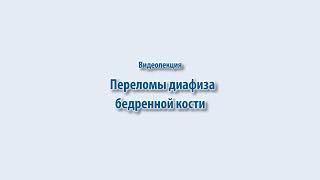 Переломы диафиза бедренной кости