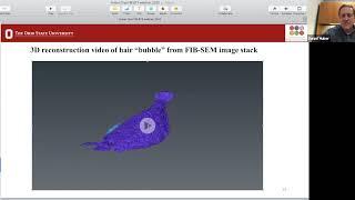 Cryo-EM and the FIB