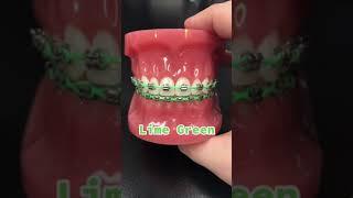 The BEST braces Colors 