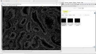 Deep learning-based segmentation for biologists - Data preparation for nuclei segmentation - U-Net