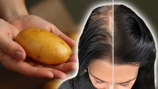 Hair grows like crazy and does not fall out! the most effective recipe!