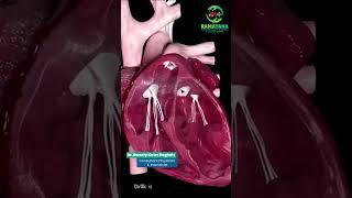 How to Control Heart Attack Risk? Dr. Sweety Katre Baghele Shares Tips
