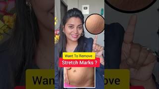 Stretch Marks Removal Pharmacy Creams #ankitasinghkuntal #stretchmarks #ytshorts  #shorts #viral