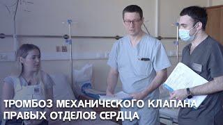 Тромбоз механического клапана правых отделов сердца