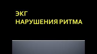 ЭКГ. Нарушения ритма сердца. Максимцева Е. А.