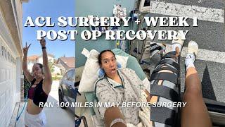 ACL SURGERY + WEEK 1 POST OP | HUGE LIFE UPDATE