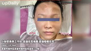 小秘密美學工作坊-高雄採耳推薦 高雄睡眠採耳 #高雄採耳 #高雄採耳推薦 #高雄睡眠採耳