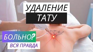 УДАЛЕНИЕ ТАТУ ЛАЗЕРОМ | Мой опыт и рекомендации