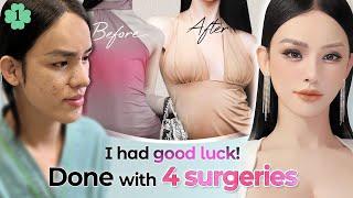 This Vietnamese model wanted to look more feminineㅣMultiple Surgeries in ONE Day with NANA!