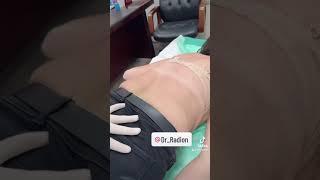 Spine treatment with back pain from Dr. Radion