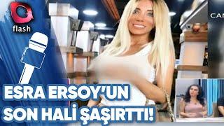 CİCİŞ ESRA ERSOY'UN SON HALİ ŞAŞIRTTI!