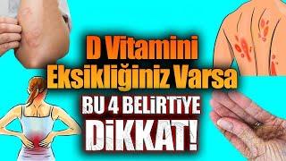 D Vitamini Eksikliğiniz Varsa Bu 4 Belirtiye Dikkat!